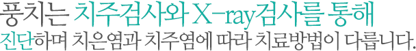 풍치는 치주검사와 X-ray검사를 통해 진단하며 치은염과 치주염에 따라 치료방법이 다릅니다.